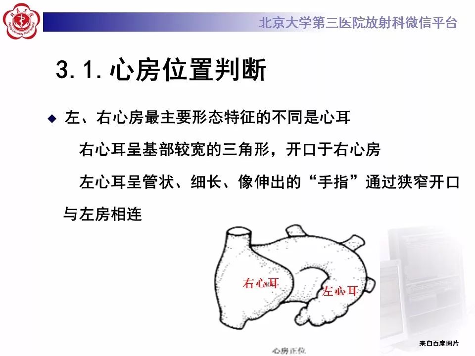 【病例】先天性心脏病诊断思路与基本征象