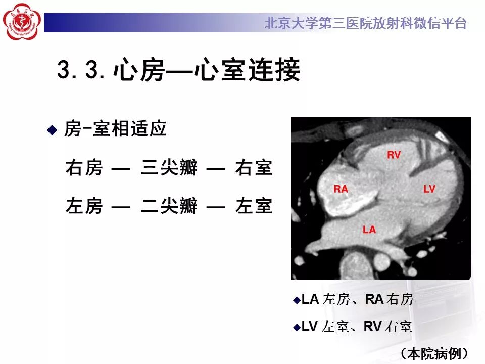 【病例】先天性心脏病诊断思路与基本征象