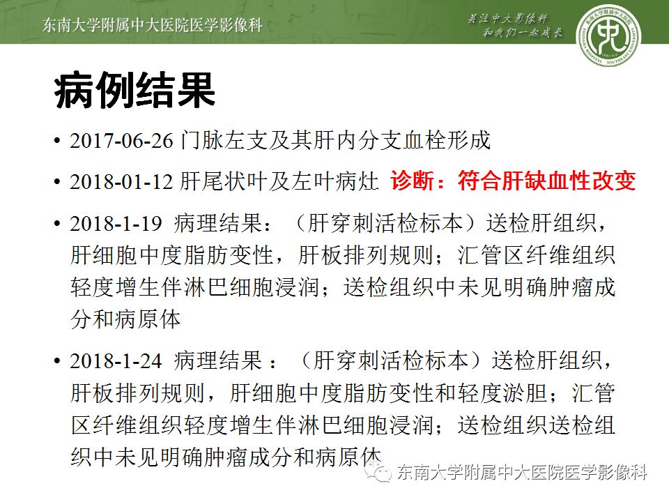 【病例】肝缺血性改变1例CT影像表现 【病例】肝缺血性改变1例CT影像表现