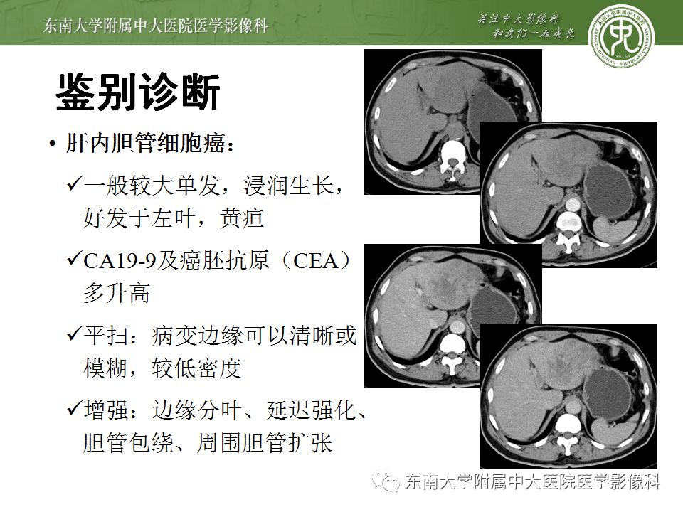 【病例】肝缺血性改变1例CT影像表现 【病例】肝缺血性改变1例CT影像表现