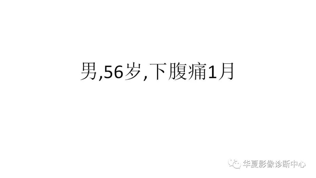 【病例】胃肠道间质瘤1例CT影像表现