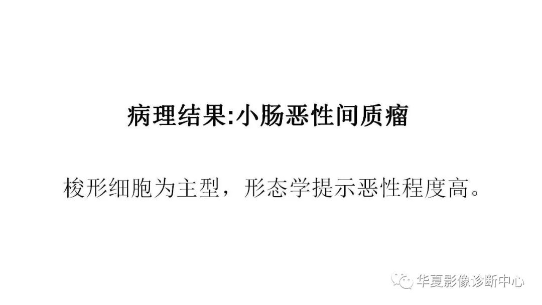 【病例】胃肠道间质瘤1例CT影像表现