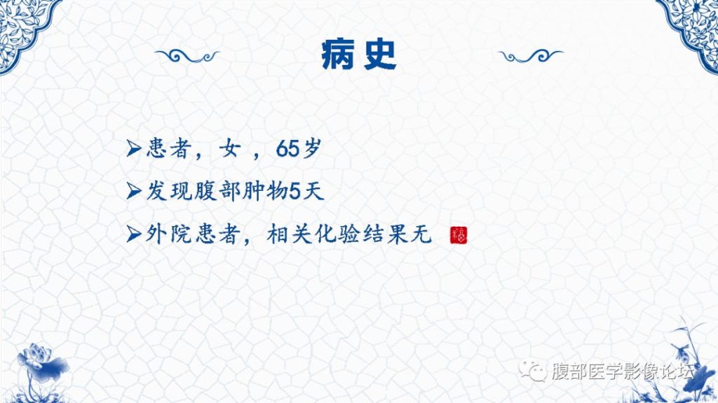 【病例】盆腔胃肠道间质瘤1例MR影像表现