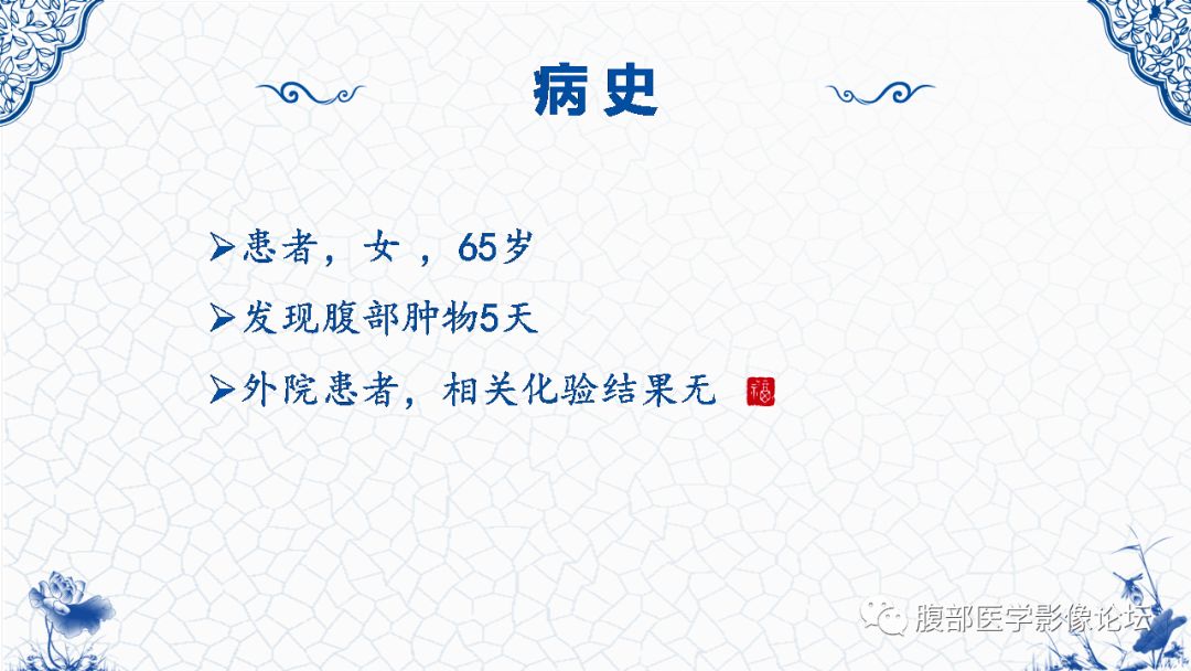 【病例】盆腔胃肠道间质瘤1例MR影像表现