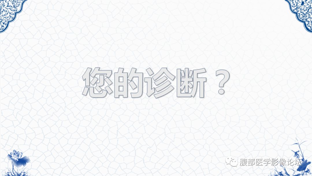 【病例】盆腔胃肠道间质瘤1例MR影像表现