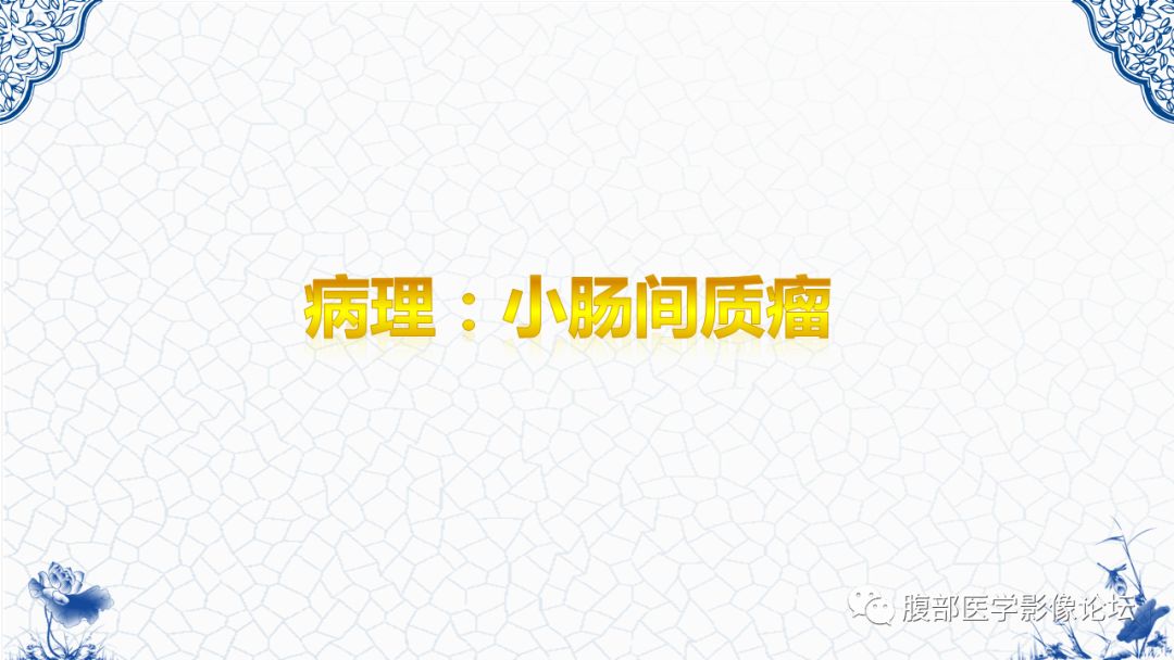 【病例】盆腔胃肠道间质瘤1例MR影像表现