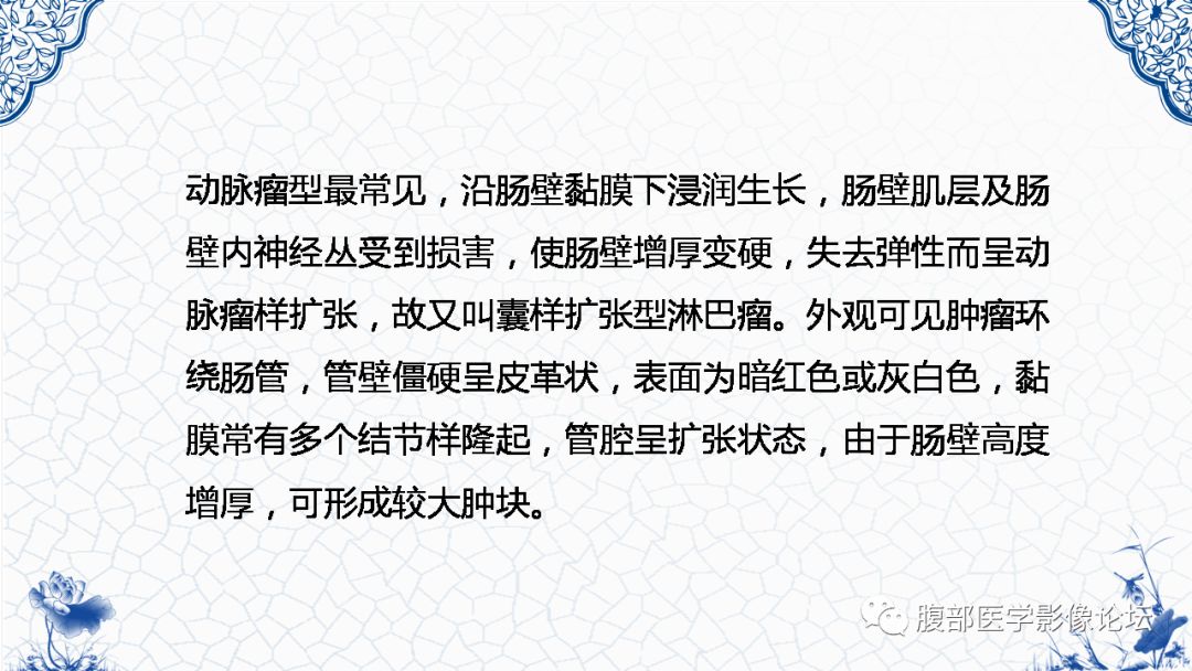 【病例】盆腔胃肠道间质瘤1例MR影像表现