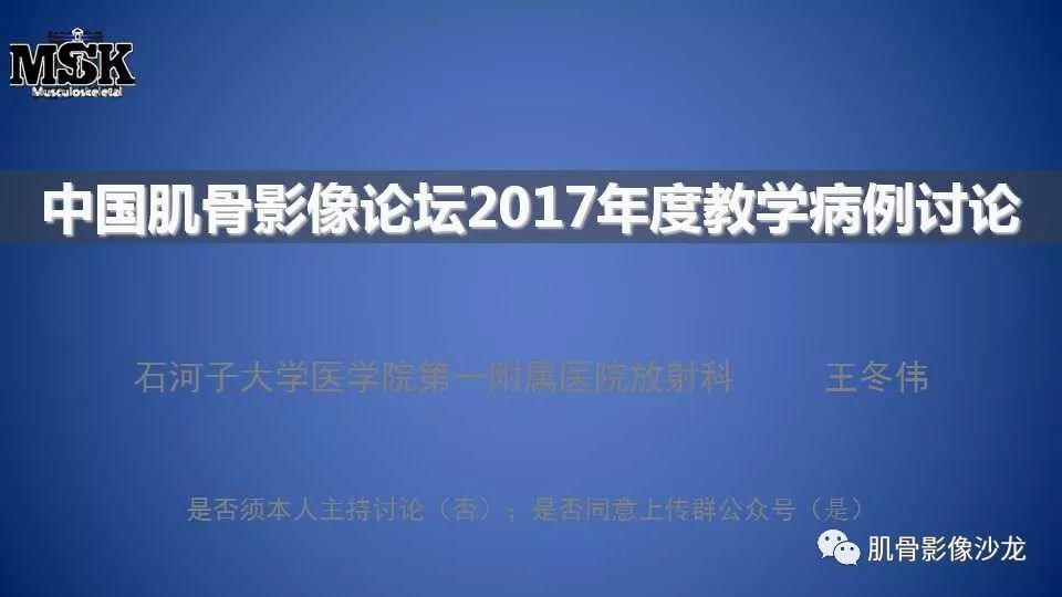 【病例】股骨骨纤维异常增殖症1例X线CT及MR影像讨论 【病例】股骨骨纤维异常增殖症1例X线CT及MR影像讨论