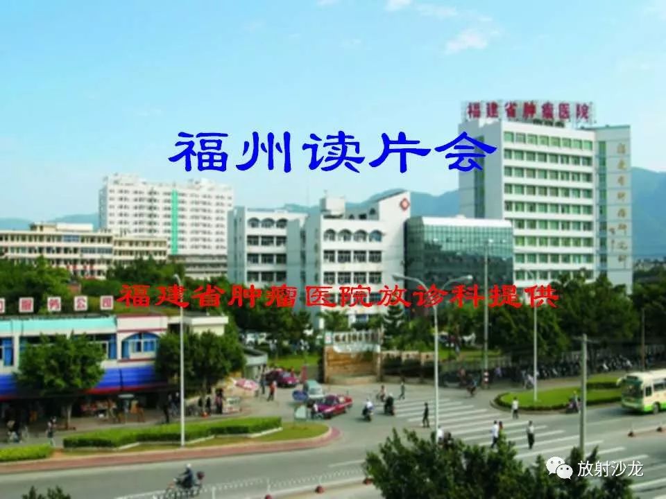 【病例】盆腔脓肿1例MR影像表现