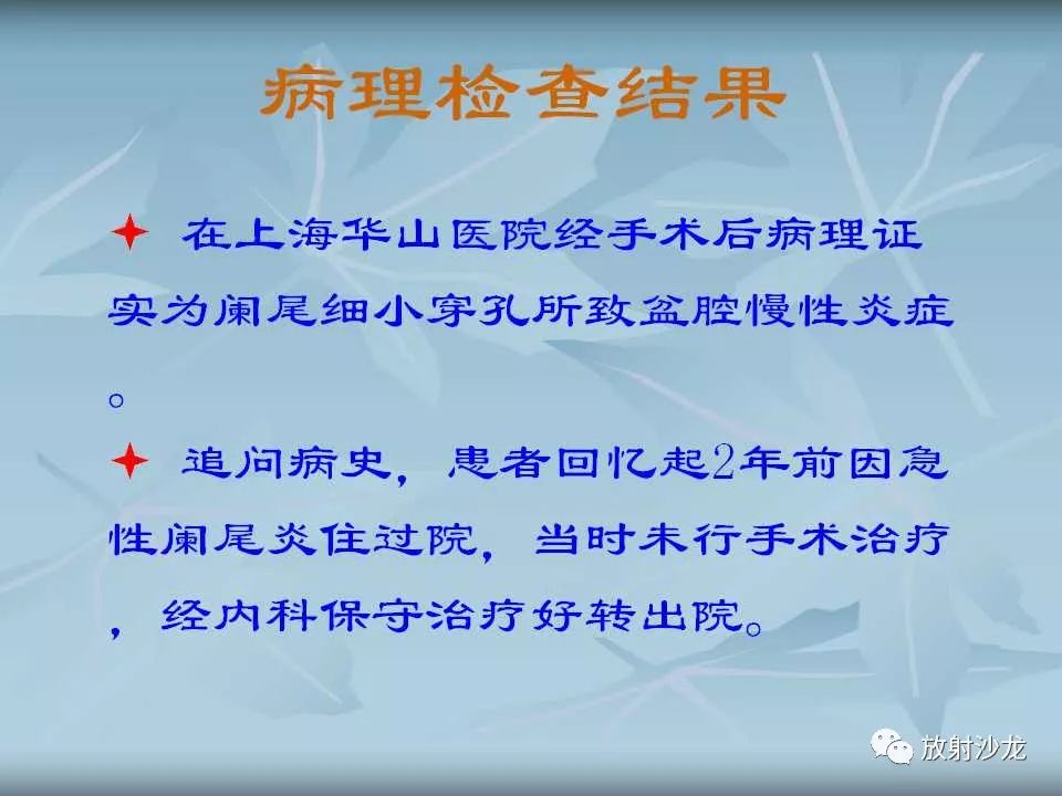 【病例】盆腔脓肿1例MR影像表现