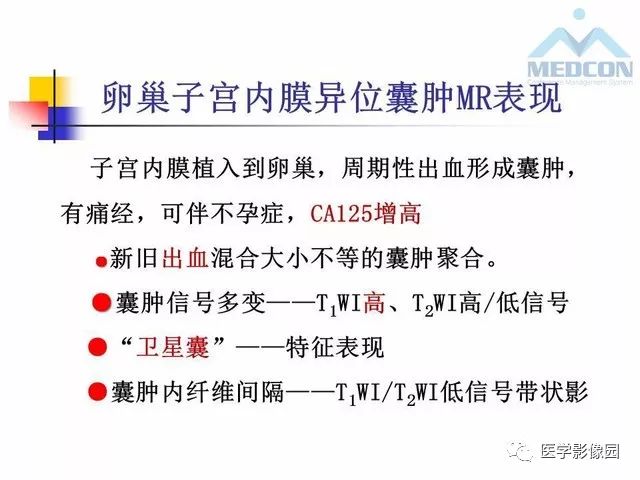 【PPT】MR对卵巢囊性病变的鉴别诊断价值