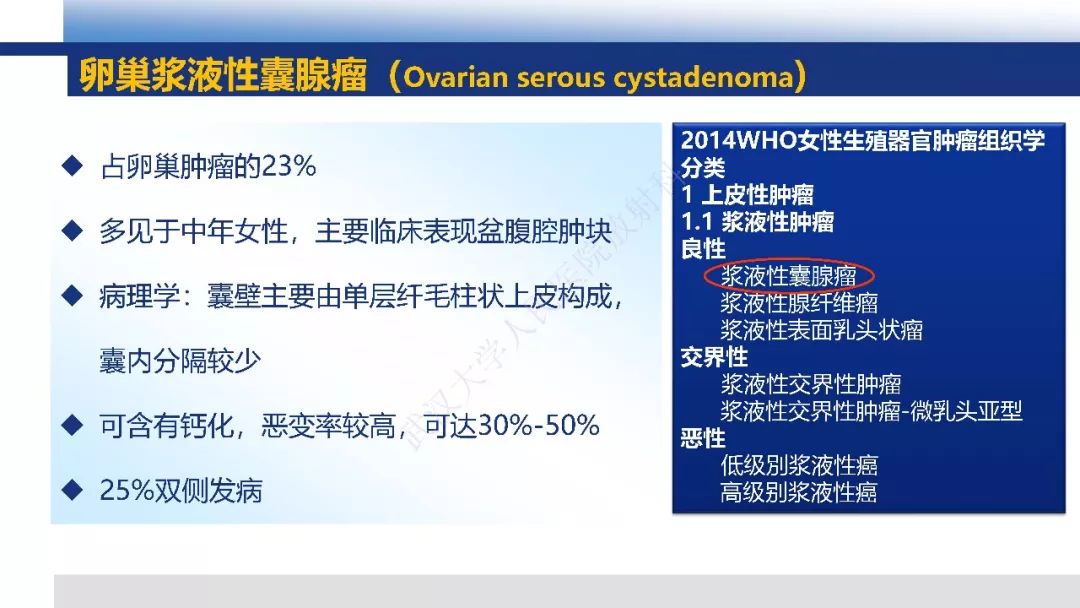 【PPT】女性盆腔囊性肿瘤性病变影像诊断