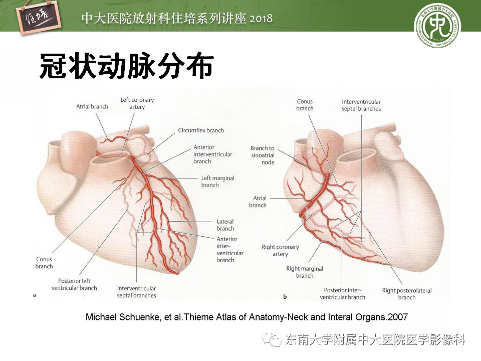 【PPT】冠脉CTA阅片要点及标准化报告