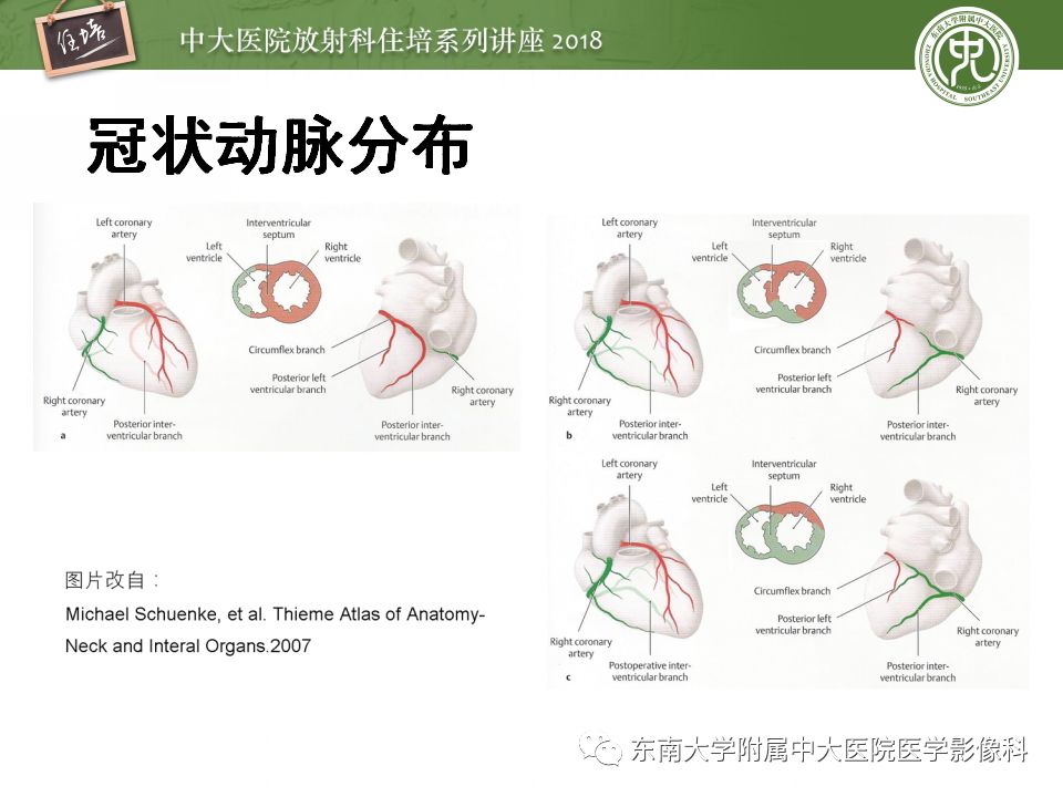 【PPT】冠脉CTA阅片要点及标准化报告