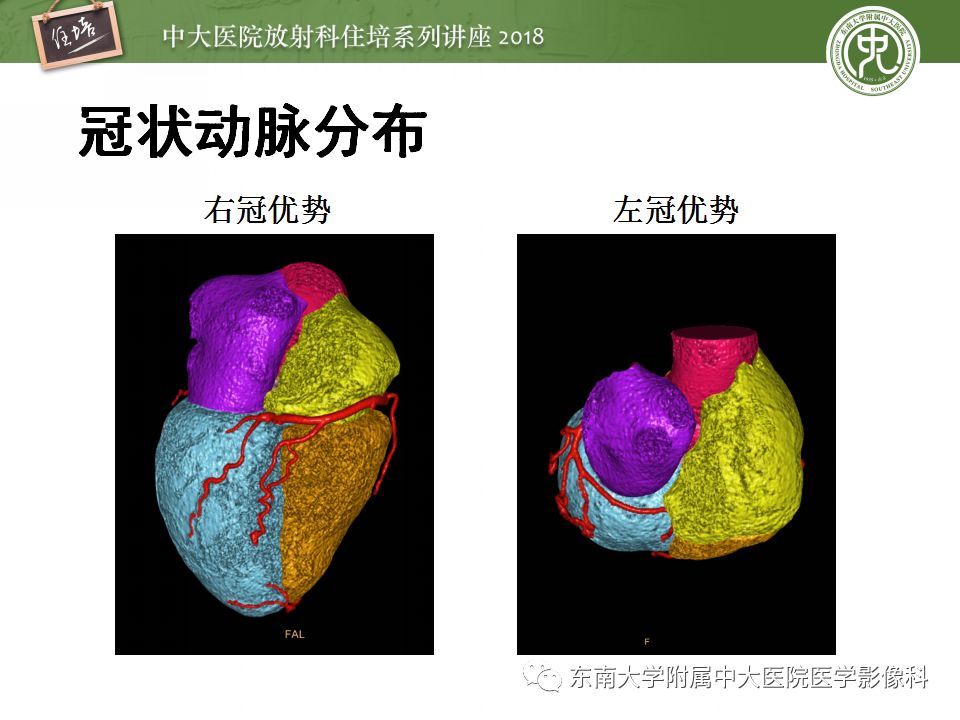 【PPT】冠脉CTA阅片要点及标准化报告
