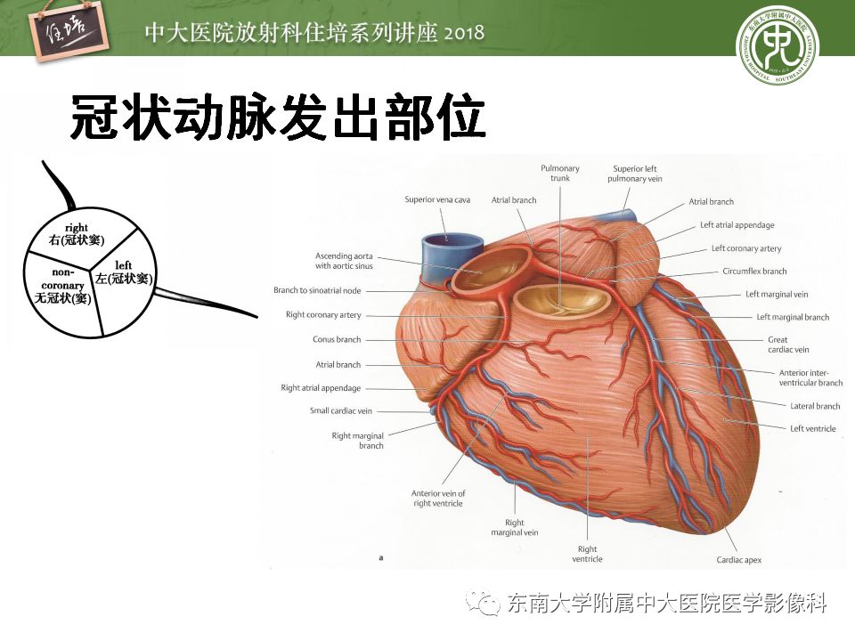 【PPT】冠脉CTA阅片要点及标准化报告