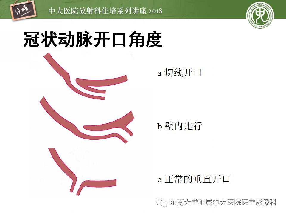 【PPT】冠脉CTA阅片要点及标准化报告
