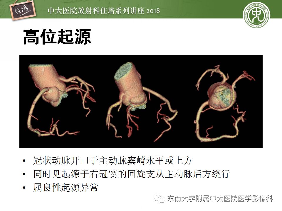 【PPT】冠脉CTA阅片要点及标准化报告