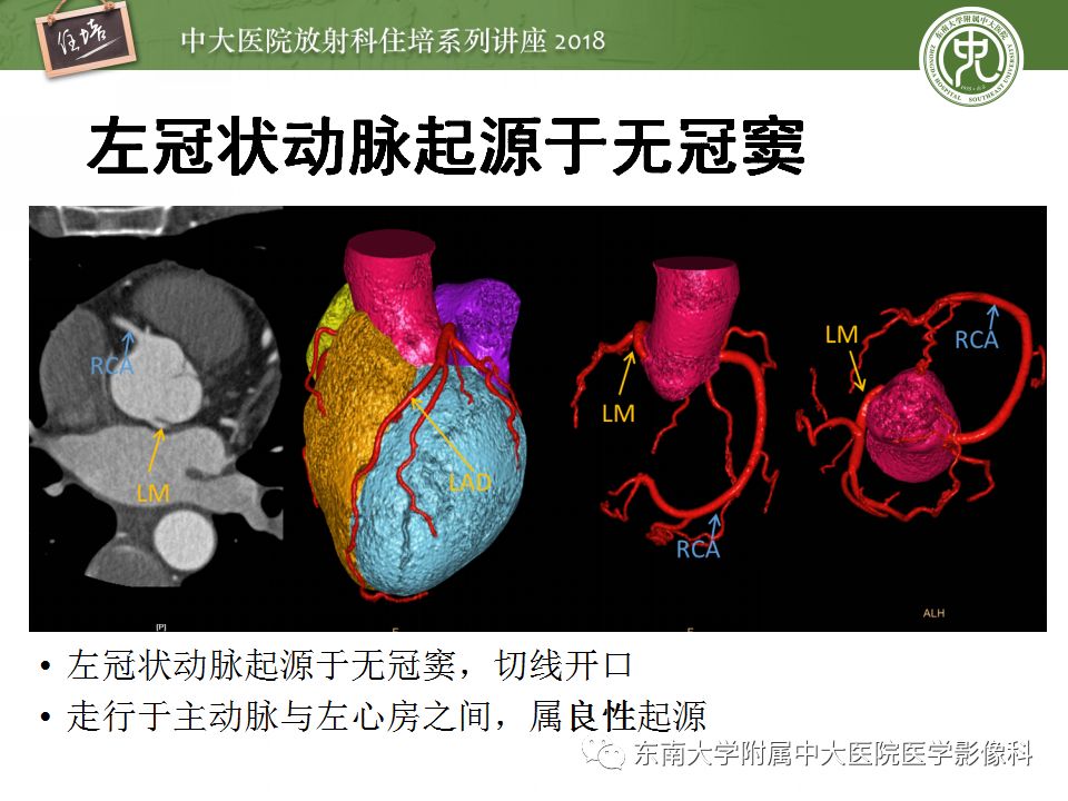 【PPT】冠脉CTA阅片要点及标准化报告