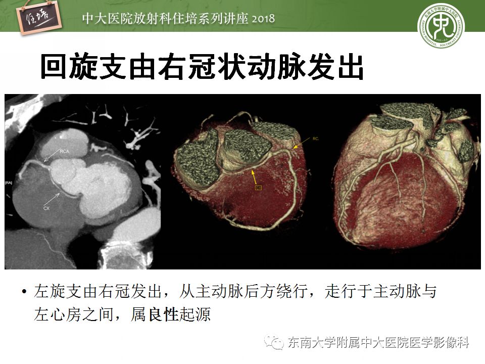 【PPT】冠脉CTA阅片要点及标准化报告
