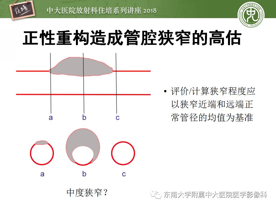 【PPT】冠脉CTA阅片要点及标准化报告