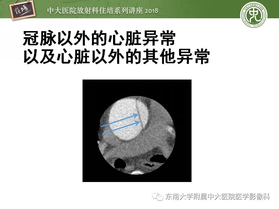 【PPT】冠脉CTA阅片要点及标准化报告