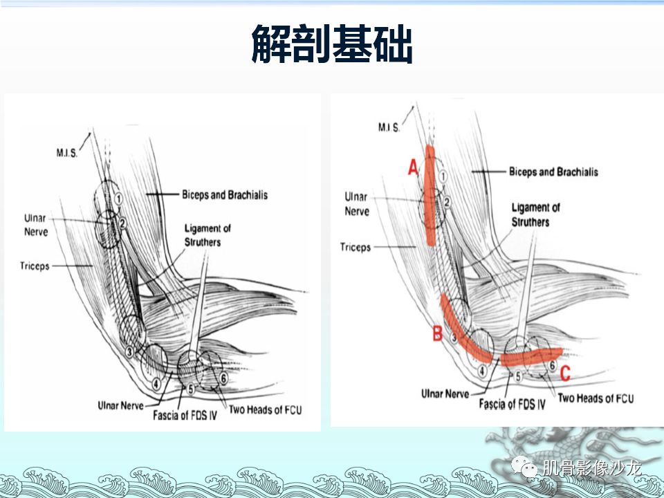 【PPT】肘管的磁共振应用研究