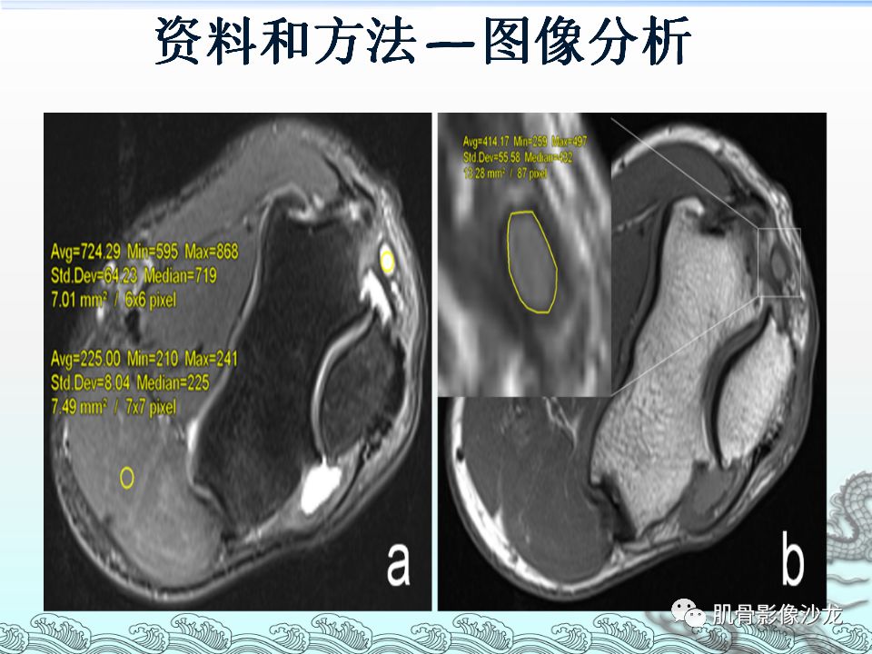 【PPT】肘管的磁共振应用研究