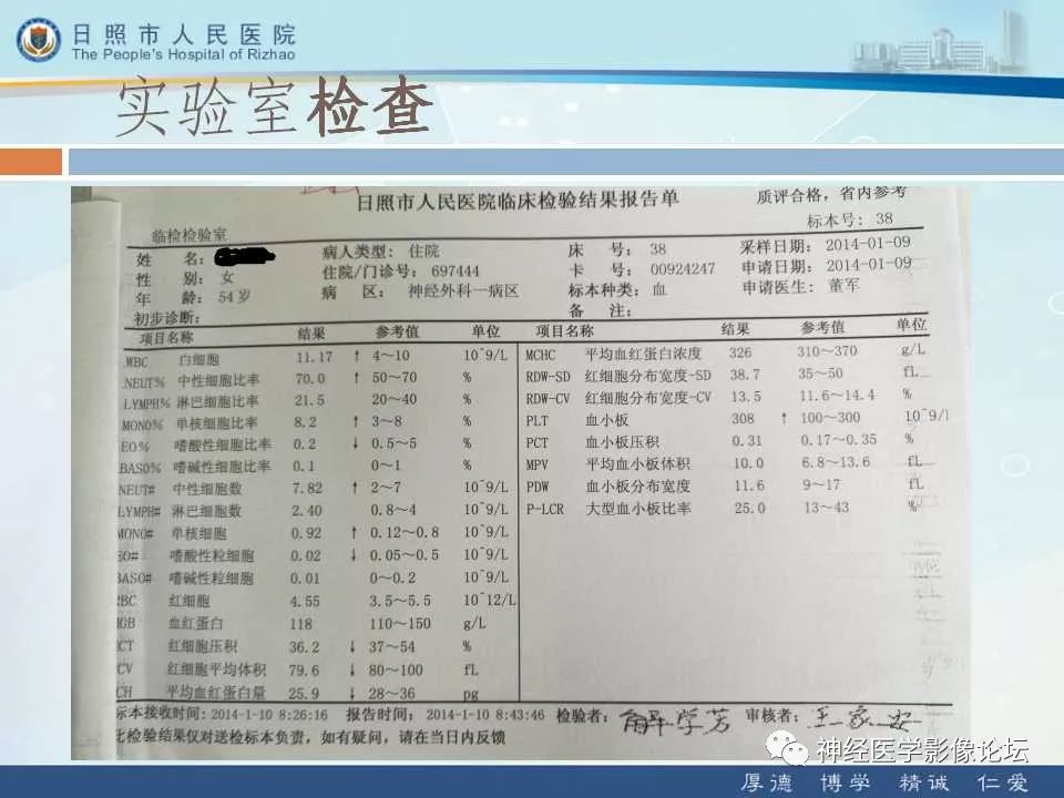 【病例】罕见颅内恶性外周神经鞘瘤一例MR