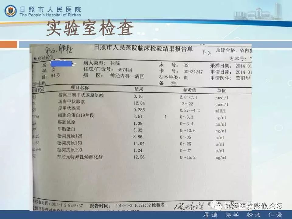 【病例】罕见颅内恶性外周神经鞘瘤一例MR