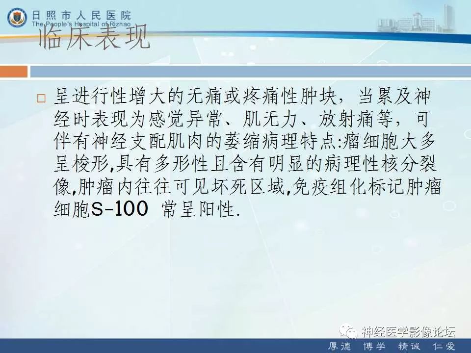 【病例】罕见颅内恶性外周神经鞘瘤一例MR