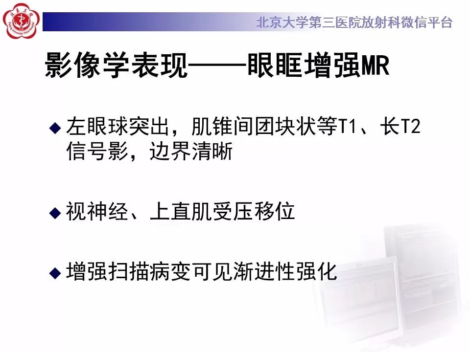 【病例】眼眶海绵状血管瘤1例CT及MR