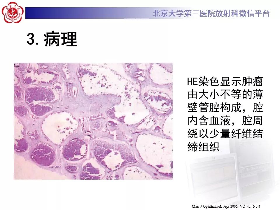 【病例】眼眶海绵状血管瘤1例CT及MR