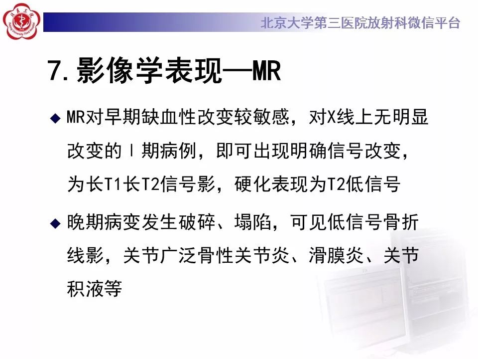 【病例】月骨缺血性坏死/无菌性坏死1例MR