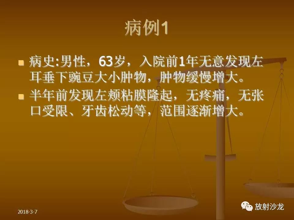 【PPT】腮腺区肿块的诊断与鉴别诊断