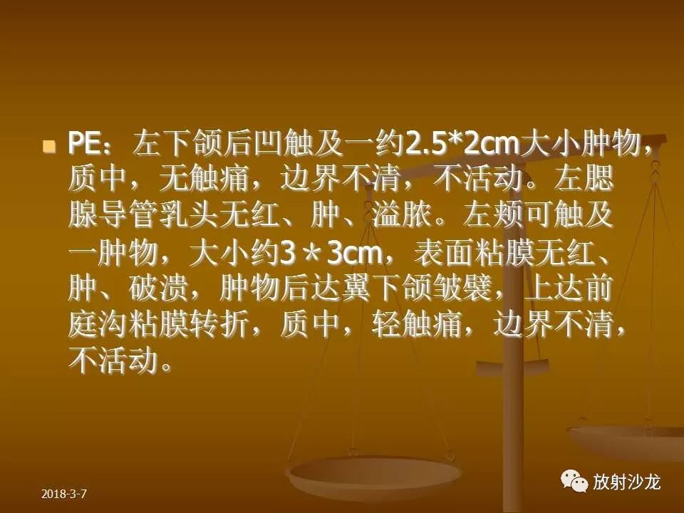 【PPT】腮腺区肿块的诊断与鉴别诊断