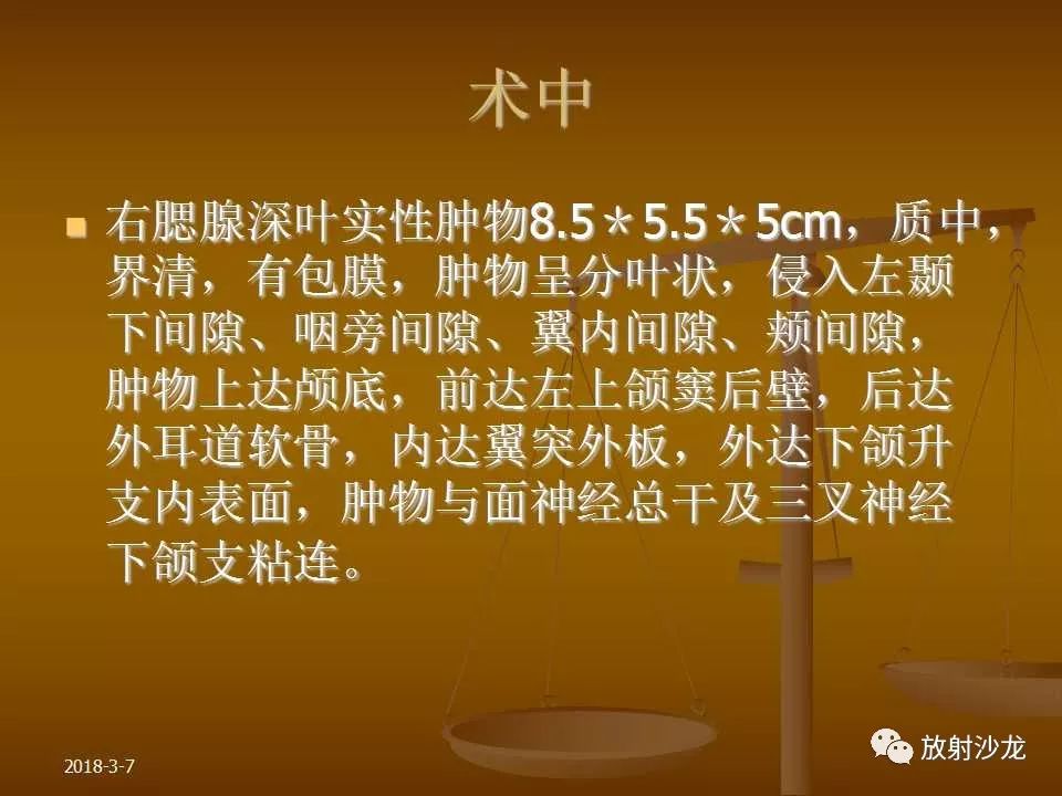 【PPT】腮腺区肿块的诊断与鉴别诊断