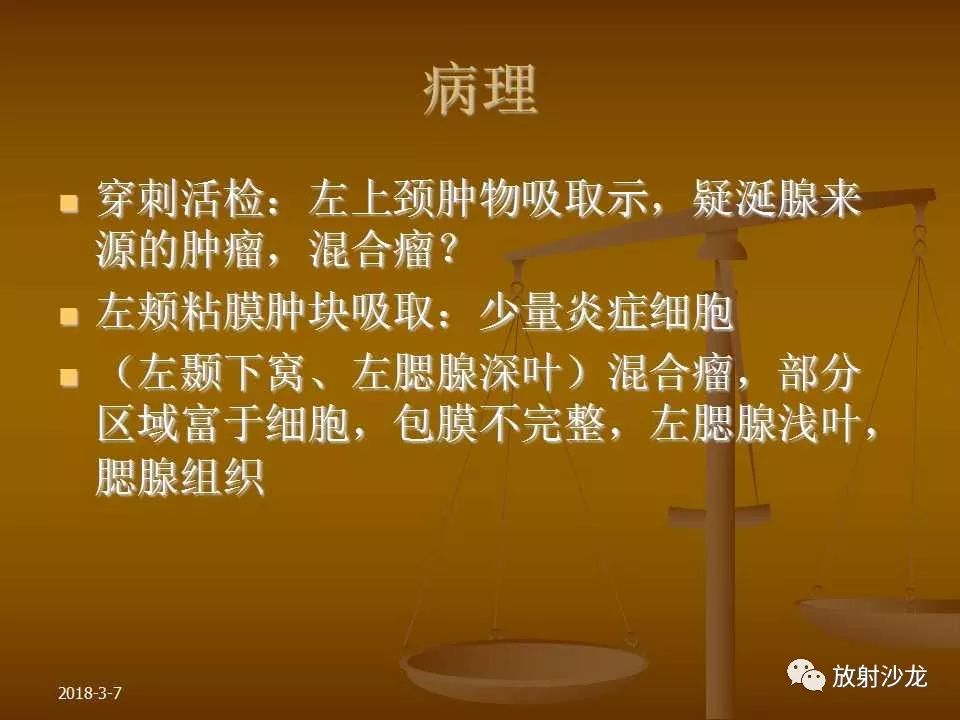 【PPT】腮腺区肿块的诊断与鉴别诊断