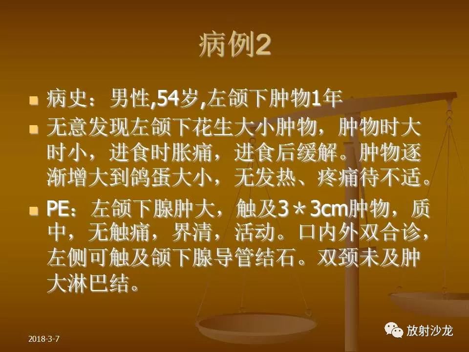【PPT】腮腺区肿块的诊断与鉴别诊断
