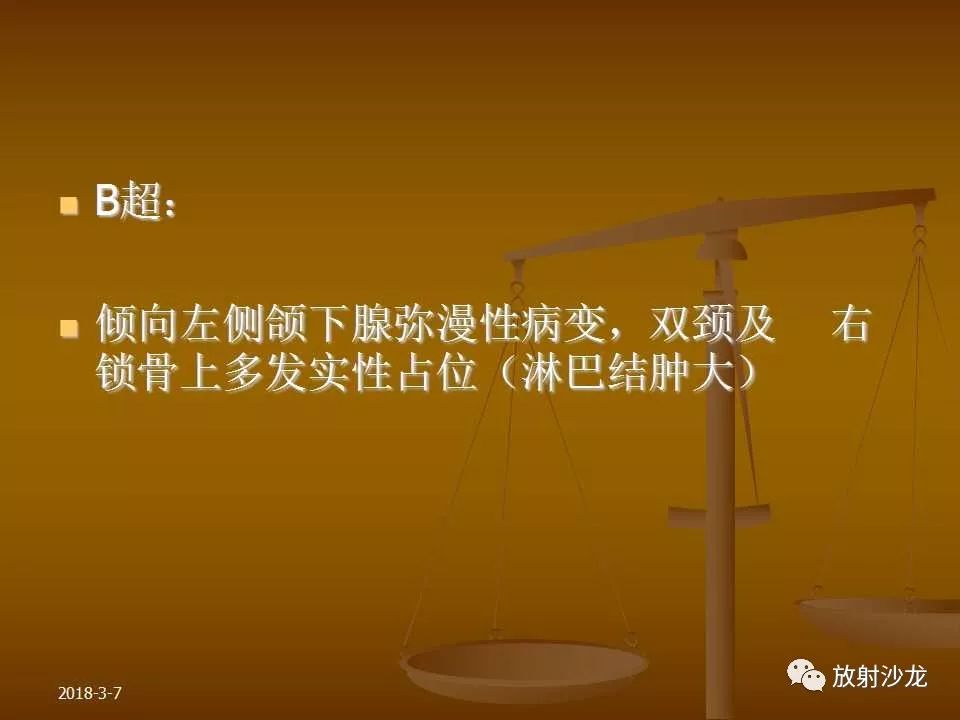 【PPT】腮腺区肿块的诊断与鉴别诊断