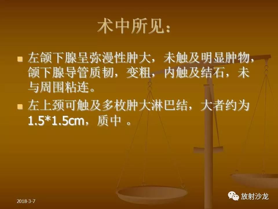 【PPT】腮腺区肿块的诊断与鉴别诊断
