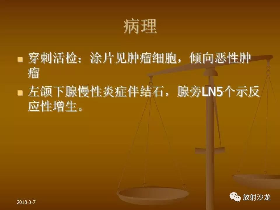 【PPT】腮腺区肿块的诊断与鉴别诊断