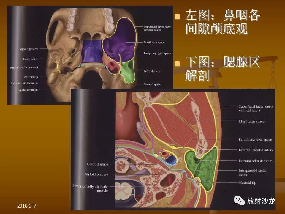 【PPT】腮腺区肿块的诊断与鉴别诊断