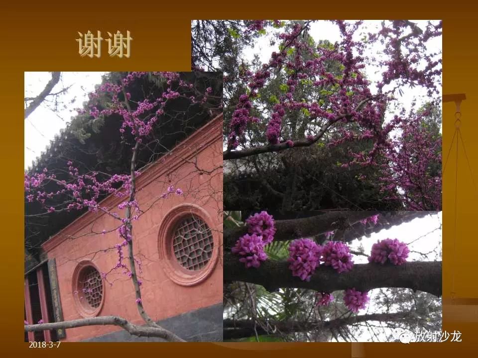 【PPT】腮腺区肿块的诊断与鉴别诊断