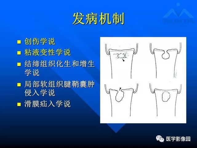 【PPT】关节周围那些囊状骨破坏的诊断与鉴别