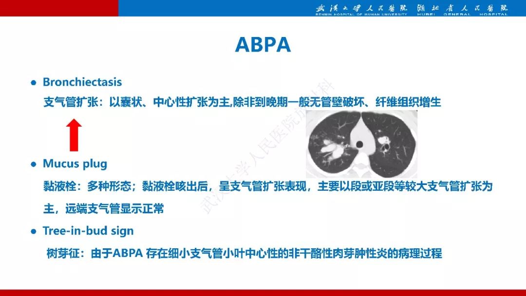 【PPT】先天性支气管闭锁影像诊断