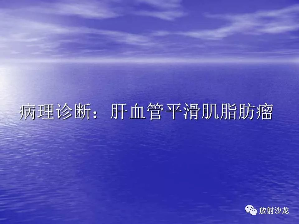【病例】小儿巨大肝脏血管平滑肌脂肪瘤1例CT影像表现