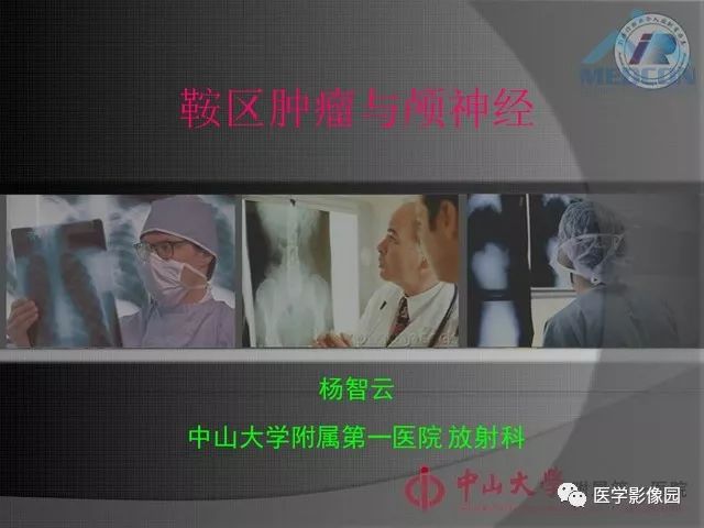 【PPT】鞍区肿瘤与颅神经