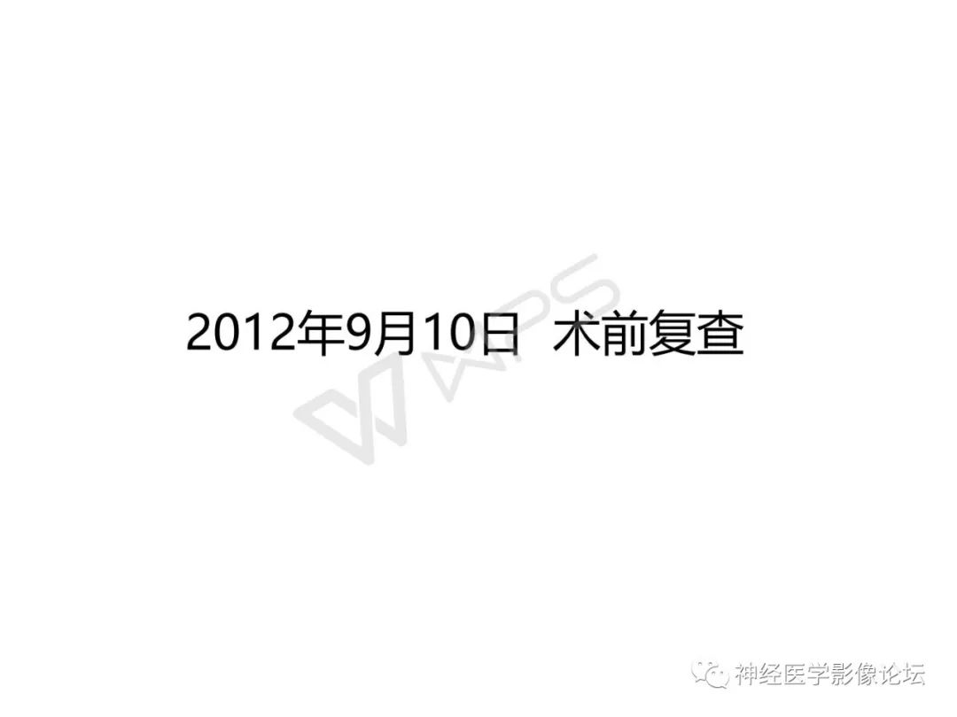 【病例】下丘脑节细胞胶质瘤一例MR影像表现