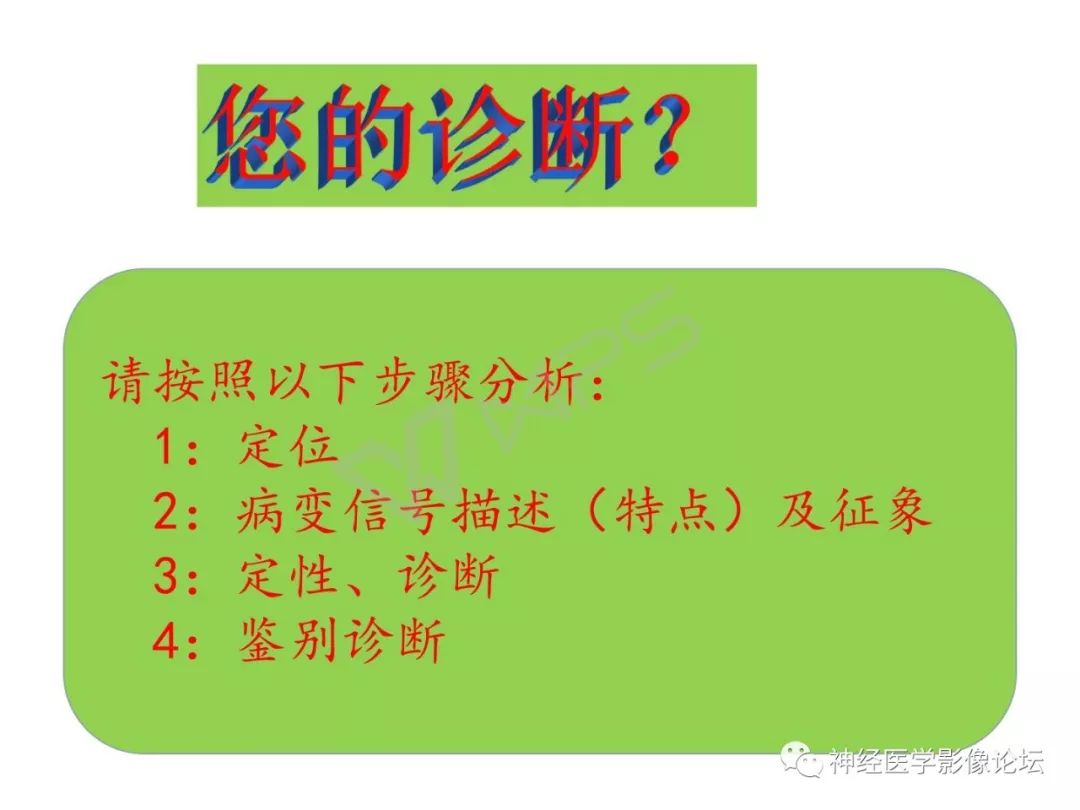 【病例】下丘脑节细胞胶质瘤一例MR影像表现